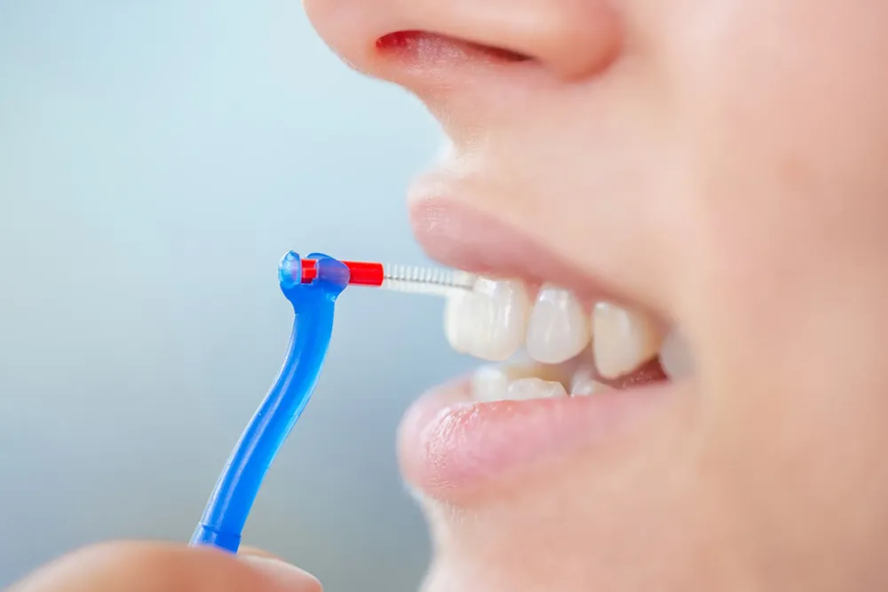 La bonne façon d'utiliser une brosse interdentaire